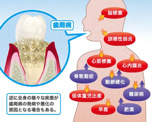 全身疾患との関係